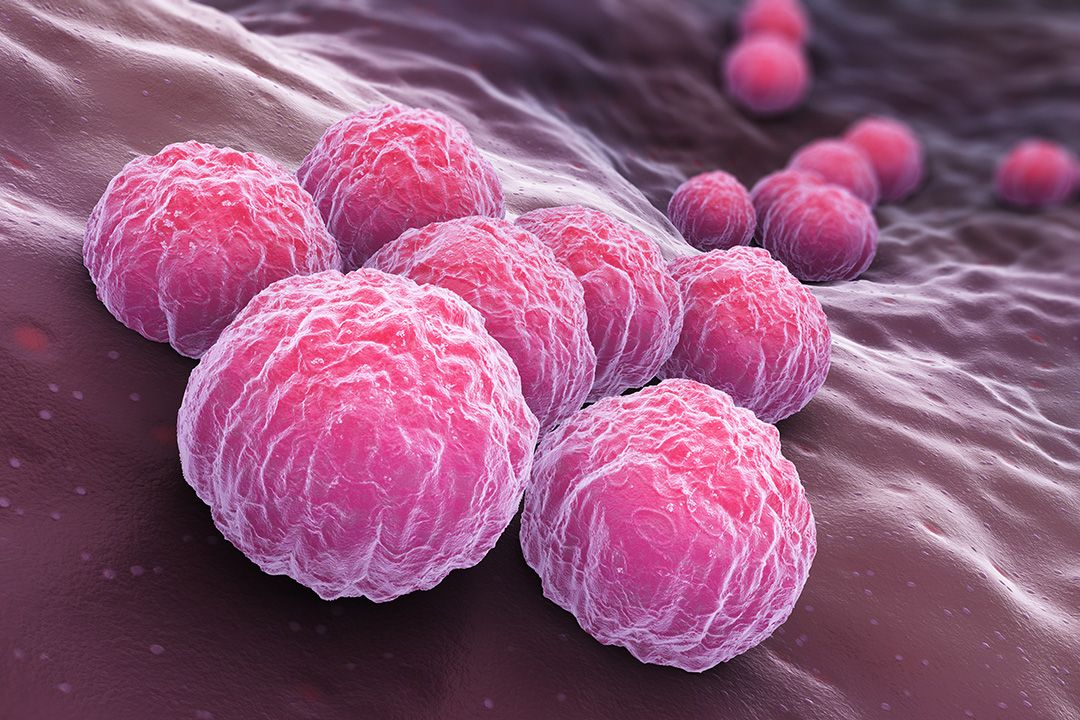 Enfermedades de transmisión sexual frecuentes: Clamidia. 
